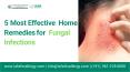 5 Most Effective Home Remedies for Fungal Infections PowerPoint PPT Presentation
