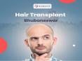 Bhubaneswar Hair Transplant Clinic (1) PowerPoint PPT Presentation