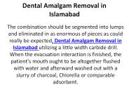 Dental Amalgam Removal in Islamabad