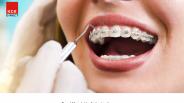Band Material in Orthodontics