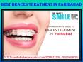 Best Orthodontist in Faridabad Available PowerPoint PPT Presentation