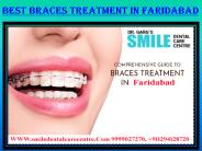 Best Orthodontist in Faridabad Available