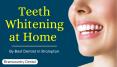 Tips for Teeth Whitening at Home by Dentist in Brampton PowerPoint PPT Presentation