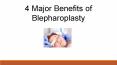 4 Major Benefits of Blepharoplasty PowerPoint PPT Presentation