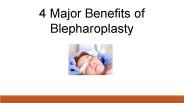4 Major Benefits of Blepharoplasty