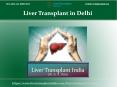 Visit Once Liver Transplant in Delhi PowerPoint PPT Presentation