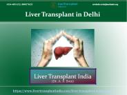 Visit Once Liver Transplant in Delhi