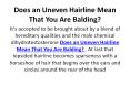 Does an Uneven Hairline Mean That You Are Balding? PowerPoint PPT Presentation