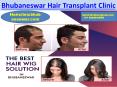 hair transplant clinic in bhubaneswar - hair doctor in cuttack PowerPoint PPT Presentation