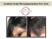Aesthetic Scalp Micropigmentation New York