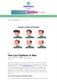 Hair Loss Problems  in Men PowerPoint PPT Presentation
