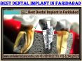 Best Dental Implant Clinic Availability in Faridabad PowerPoint PPT Presentation
