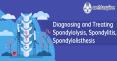 Diagnosing and Treating Spondylolysis, Spondylitis, Spondylolisthesis | Children and Adult Spinal Surgeon, UK PowerPoint PPT Presentation