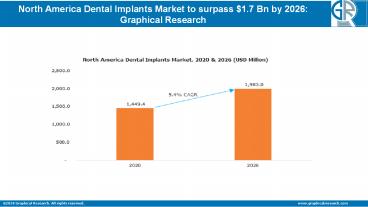 Dental Implants Market in North America 2020 By Regional Trend & Growth Forecast To 2026