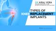 Types of Knee Replacement Implants | Dr Niraj Vora PowerPoint PPT Presentation