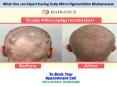 What One can Expect having Scalp Micro Pigmentation Bhubaneswar (1) PowerPoint PPT Presentation