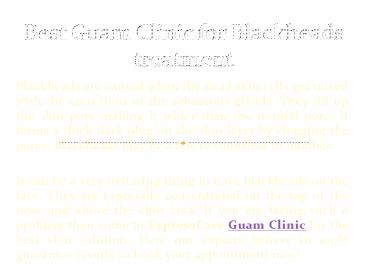 Best Guam Clinic for Blackheads treatment