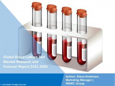 Blood Culture Test Market PPT: Trends and Dynamics, Drivers, Competitive landscape and Future Opportunities