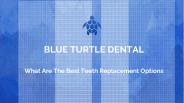 What Are the Best Teeth Replacement Options?