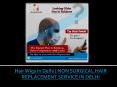 Hair Wigs in Delhi | NON SURGICAL HAIR REPLACEMENT SERVICE IN DELHI PowerPoint PPT Presentation