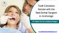 Tooth Extraction Service with the Best Dental Surgeon in Anchorage PowerPoint PPT Presentation