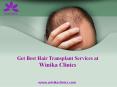 Get Best Hair Transplant Services at  Winika Clinics PowerPoint PPT Presentation