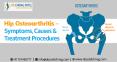 Hip Osteoarthritis – Symptoms, Causes & Treatment Procedures | Dr Chirag Patel PowerPoint PPT Presentation