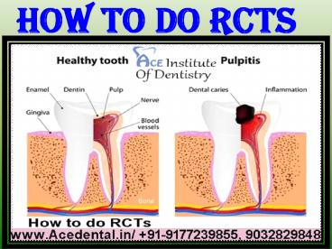 What after BDS? And How to Clear MDS NEET 2021 Exams