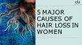 5 Major Causes of Hair Loss in Women: DoU Wigs PowerPoint PPT Presentation
