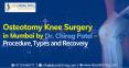 Osteotomy Knee Surgery in Mumbai by Dr. Chirag Patel – Procedure, Types and Recovery PowerPoint PPT Presentation