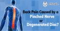 Back Pain Caused by a Pinched Nerve or Degenerated Disc? - Mehta Spine PowerPoint PPT Presentation