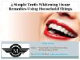 4 Simple Teeth Whitening Home Remedies Using Household Things PowerPoint PPT Presentation