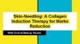 Skin-Needling: A Collagen Induction Therapy for Marks Reduction PowerPoint PPT Presentation