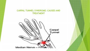 CARPAL TUNNEL SYNDROME: CAUSES AND TREATMENT