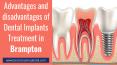 Advantages and disadvantages of Dental Implants Treatment in Brampton PowerPoint PPT Presentation