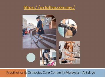 Prosthetics &  Orthotics Care Centre In Malaysia | ArtaLive