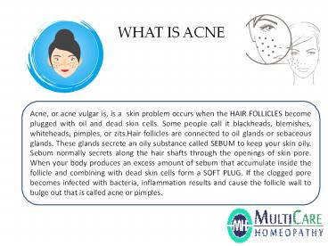 Best Homeopathy acne doctor in bhubaneswar