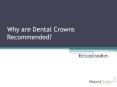 Why are Dental Crowns Recommended? PowerPoint PPT Presentation