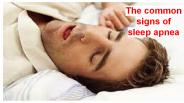 sign of sleep apnea