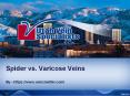 Spider vs. Varicose Veins PowerPoint PPT Presentation