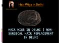 HAIR WIGS IN DELHI | NON-SURGICAL HAIR REPLACEMENT IN DELHI PowerPoint PPT Presentation
