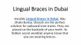Lingual Braces in Dubai PowerPoint PPT Presentation