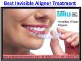 Need Best Invisible Aligner Treatment in Faridabad Then Visit Smile Dental PowerPoint PPT Presentation