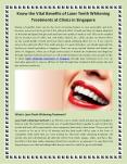 Benefits of Laser Teeth Whitening Treatments at Clinics in Singapore PowerPoint PPT Presentation