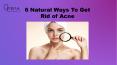 6 Natural Ways To Get Rid of Acne PowerPoint PPT Presentation