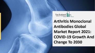 Global Arthritis Monoclonal Antibodies Market Opportunities And Strategies To 2030