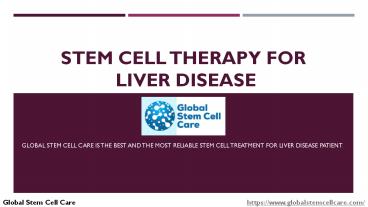 Stem Cell Therapy For Liver Disease