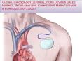 Cardiology Defibrillators Devices Sales Market Industry Trends & Forecast Report 2027 PowerPoint PPT Presentation