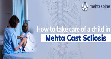 How to take care of a child in Mehta Cast Scoliosis - Mehta Spine - Children and Adult Spinal Surgeon, UK