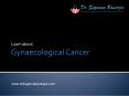 What Causes Gynaecologic Cancer? PowerPoint PPT Presentation